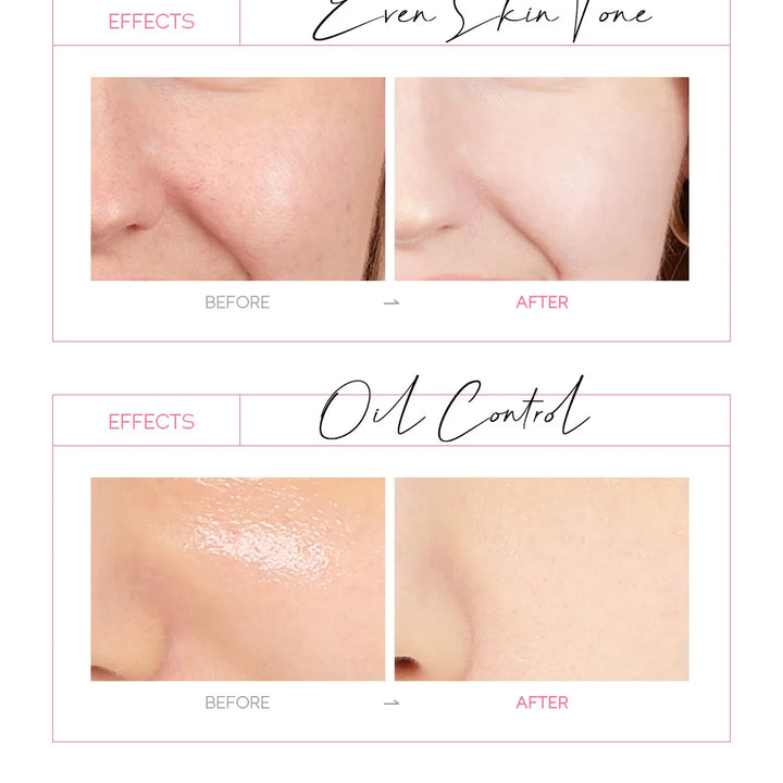 LAIKOU 24K Gold Sakura Peeling Mask – Anti-Ageing, Brightening & Blackhead Removal